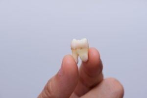 Hand holding tooth