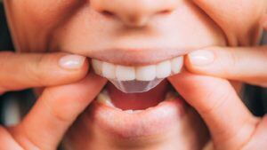 Close up of person using teeth whitening strip